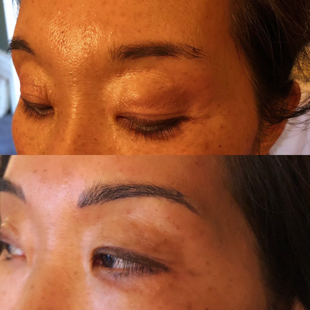 Patient 5 before and after first microblading session.